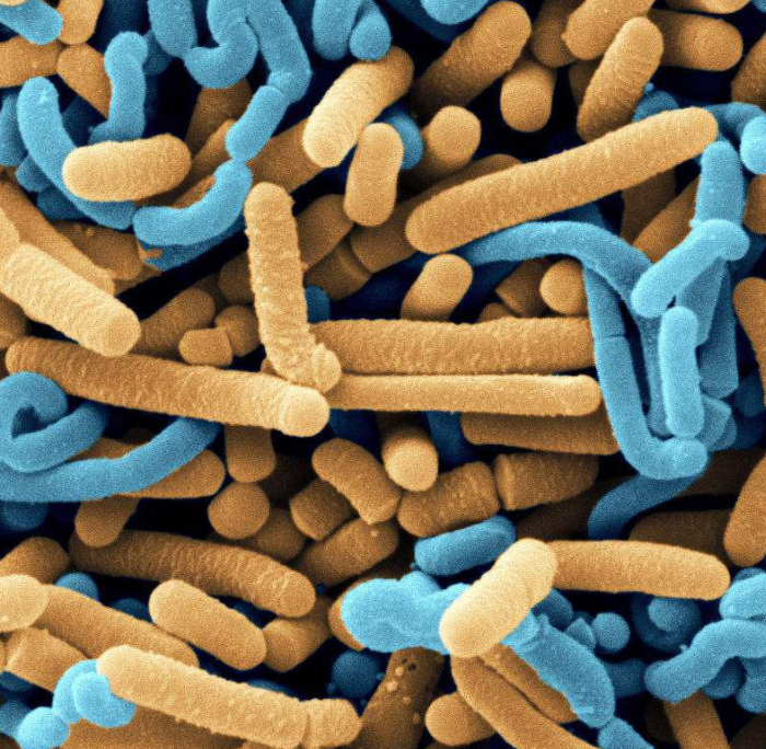 probiotic supplements의 장점